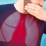 Lung cancer isn’t just a smoker’s disease, say oncologists and warn on early signs this awareness month